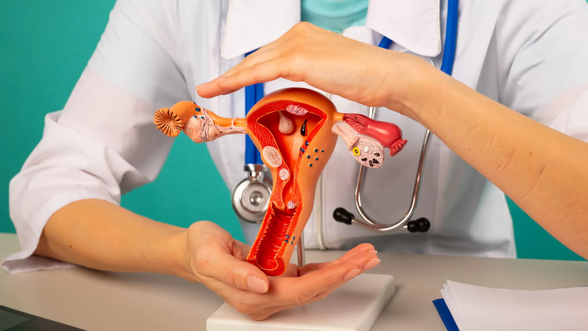 Doctor demonstrating uterine fibroid treatment using an anatomical uterus model